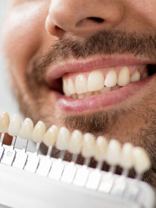 Why Consider Porcelain Veneers for Changing the Appearance of Your Smile?