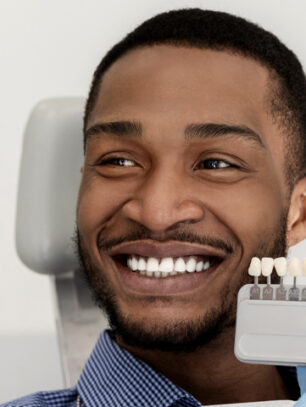 veneers-recommended